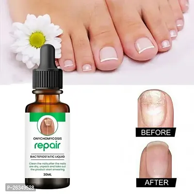 Nail Cuticle Oil For Nails Growth And Strength