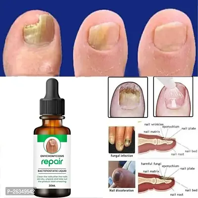 Nail Cuticle Oil For Nails Growth And Strength-30ML