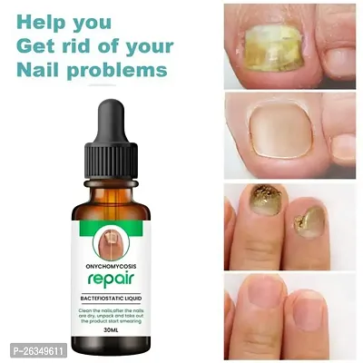 Nail Cuticle Oil For Nails Growth And Strength