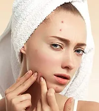 Dermina Face wash For Acne,Blackheads,Darks Spot Reducti-thumb1