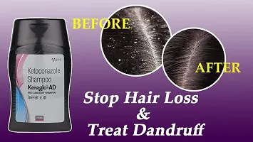 Natural Hair Care AD Anti-Dandruff Shampoo-thumb4