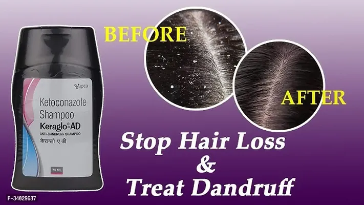 Natural Hair Care AD Anti-Dandruff Shampoo-thumb5