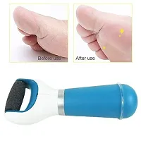 OZKET Foot Scrubber for Dead Skin Tools for Feet Foot Scrubber for Women Callus Remover for Feet Electronic Smooth and Soft Feet Scrubber Cracked Heels Remover (MULTI COLOR)-thumb1