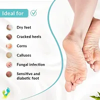 Fixderma Foobetik Cream, Foot cream, Foot care for diabetic, For Dry  Cracked Feet, Moisturizes  Soothes Feet, Heel Repair, For Calloused, or Chapped Skin, Paraben Free - 50g-thumb2