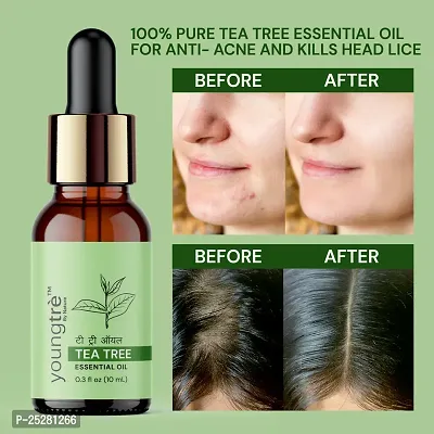 Youngtre By Nature Tea Tree Essential Oil 100% Pure  for Skin Acne,Pimple, Face, Hair-10ml-thumb0