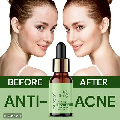 Youngtre By Nature 100% Pure Australian Tea Tree Oil Pure For Anti Acne  Glowing Skin Hair Oil (10 ml)