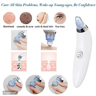 Electric Derma suction Machine | Acne Pimple Pore Cleaner Vacuum tools-thumb0