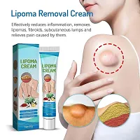 Lipoma Remover Cream Lump Remover Fat lump Remover-thumb2