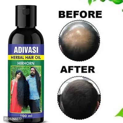 Adivasi Hair Growth Oil For Healthy Hair Care oil Hair Oil-thumb0