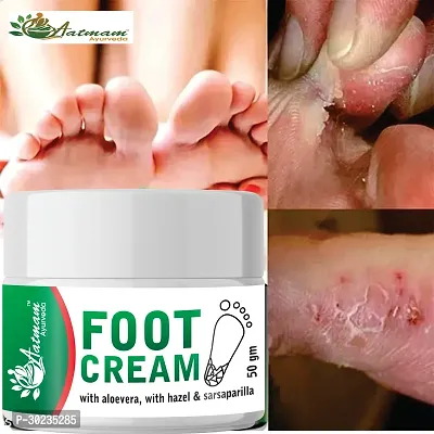 Ayurveda Foot Cream For Cracked-thumb0