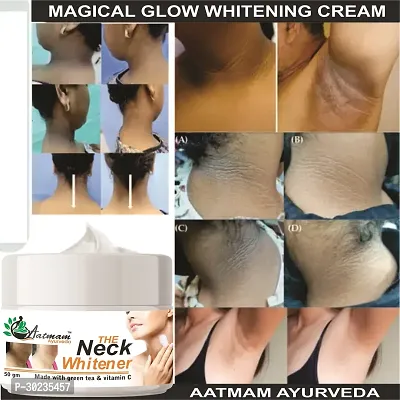 Ayurveda Neck Whitener Cream-thumb0