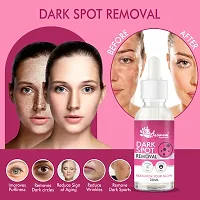 Premium Dark Spots Removal Face Serum-thumb2