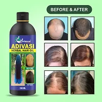 Aatmam Ayurveda Adivasi Herbal Hair Growth Oil 100ml (Pack of 01)-thumb2