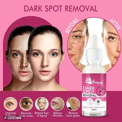 Aatmam Ayurveda Dark Spot Removal Face Serum (Pack of 01)