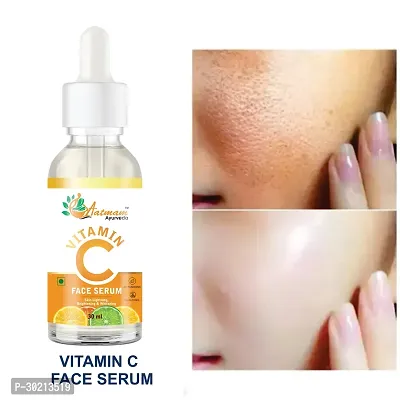 Classic Bright complete Vitamin C Booster Face Serum 30ml ,Pack of 1-thumb0