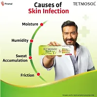 Tetmosol Plus Cream - topical antifungal cream - kills fungus, relieves itching, fights skin infections - Pack of 4 (4 x 10g)-thumb1