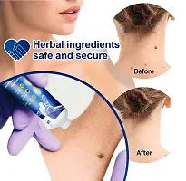 HOTBEAUTY Warts Remover Skin Face Tag Extract Painless Treatment Ointment For Men  Women  (100 g)-thumb2