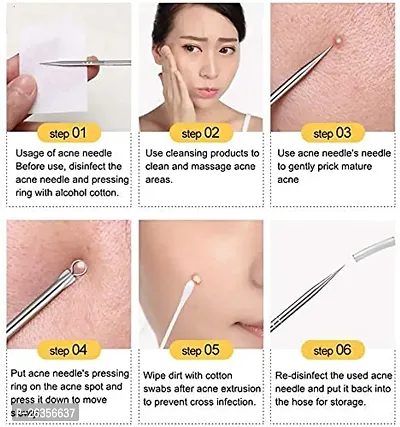 HOT BEAUTY Stainless Steel Blackhead Pimple Blemish Extractor/Remover Tool - Set of 4-thumb4