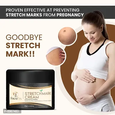 Focufix Stretch Marks Cream to Reduce Stretch Marks  Scars (100 ml) Cream (Pack of 1)-thumb0