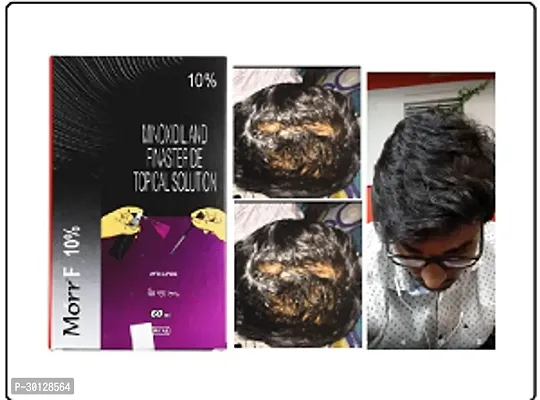 Hair Care New Morr F10% Hair Solution-thumb0