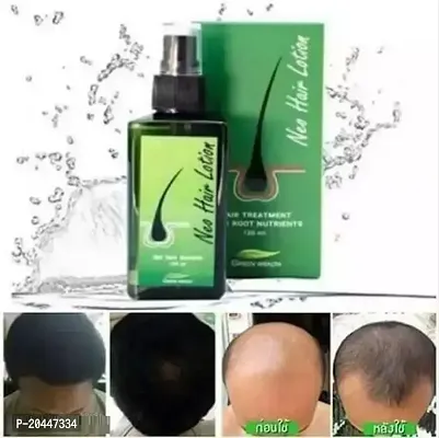 Neo Hair Lotion, GreenWealth Hair Lotion 120ml PACk OF 1#