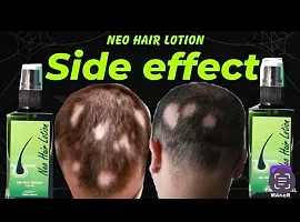 Neo Hair Lotion, GreenWealth Hair Lotion 120ml PACk OF 1#-thumb2