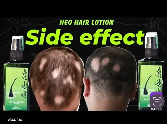 Neo Hair Lotion, GreenWealth Hair Lotion 120ml PACk OF 1#-thumb3