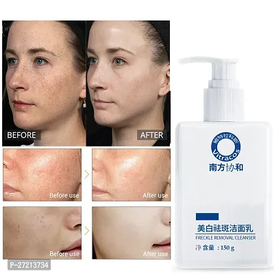 freckle removal Cleanser - Plant Compound brightening Facial Cleanser Glowing  Refreshing skin Face Wash-thumb3