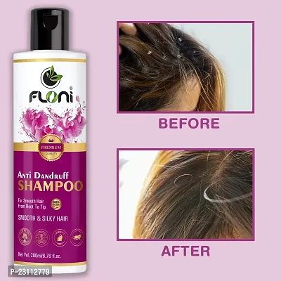 Floni Anti Dandruff Shampoo for Women  Men Paraben free for Silky And Shining Hair 200 mL-thumb3