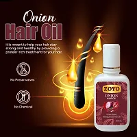 Zoyo Onion Hair Oil 100 Ml-thumb1