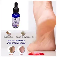 Harsh Love Foot Repair serum for Rough, Dry and Cracked Heels For Men  Women Pack of 1-thumb2