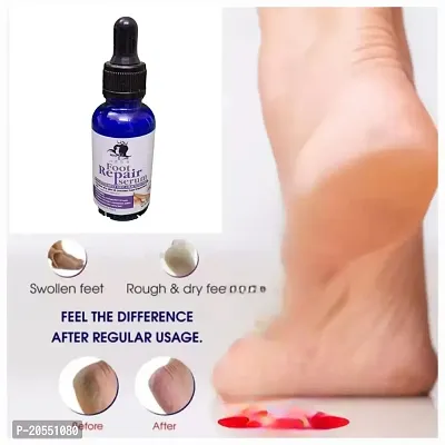 Harsh Love Foot Repair serum for Rough, Dry and Cracked Heels For Men  Women Pack of 1-thumb3