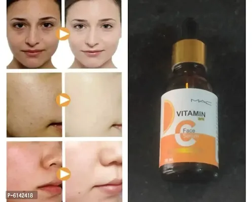 Vitamin C Face Serum - Skin Clearing Serum - Brightening, Anti-Aging Skin Repair, Supercharged Face Serum, Dark Circle, Fine Line and Sun Damage Corrector, Genuine 20% - 30ml-thumb0