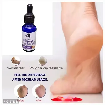 HARSHLOVE foot repair serum for healing roughfness / dryness of foot