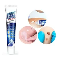 Wart Remover Cream with Pearl Soap-thumb1