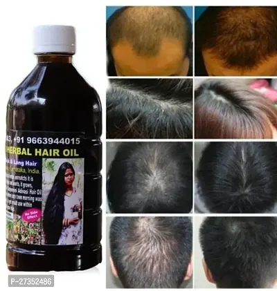 Adivasi Yurvedic Strong Roots Oil, Privents Hair Fall Good For Hair Growth Hair Oil (100 Ml) Pack Of 1