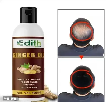 Ginger Germinal 5 Days Ginger Hair Nutrient Solution Herbal Oil Hair Oil For Women And Men For Shiny Hair Long - Dandruff Control - Hair Loss Control - Long Hair - Hair Regrowth Hair Oil ( Ayurvedic) Pack Of 1, Capacity- 100ML-thumb0