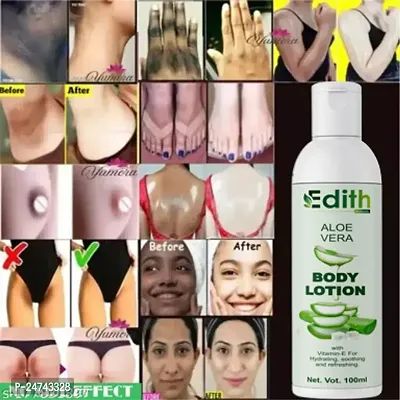 Edith Naturals Aloe Vera Skin Whitening  Brightening Hand  Body Lotion SPF - 15+-200 ml-thumb0