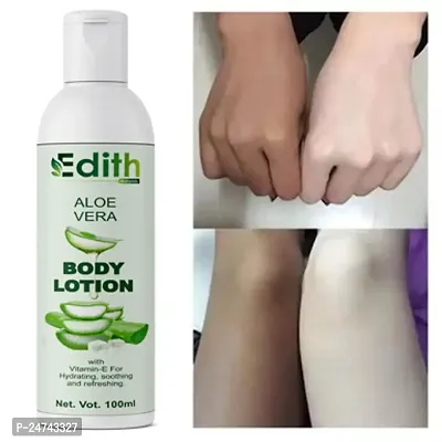 Edith Naturals Aloe Vera Skin Whitening  Brightening Hand  Body Lotion SPF - 15+-200 ml-thumb0