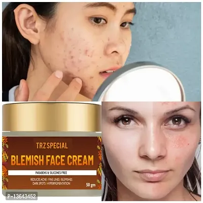 Blemish Face Cream | Anti Acne (Pimple)  Anti Blemishes Cream for Women  Men | Pigmentation, Fine Lines, Pimples, Dark Spots  Scars Removal Cream