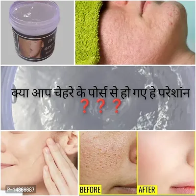Open Pores Solution Face Cream For Women For Open Pores,Dark Spots ,Face Whiteningnbsp;andnbsp;Oilynbsp;skin Face Glow Night Cream-thumb0