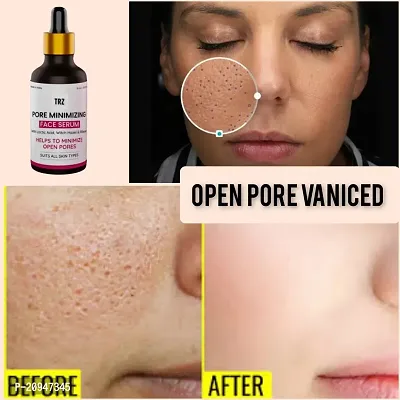 Bye Bye Open Pore Serum For Pore Tightening And Pore Minimizing 30ml