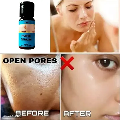 Open Pore Serum For Acne-thumb0