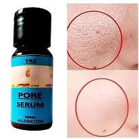 Open Pore Serum For Acne-thumb1