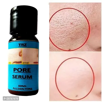 Open Pore Serum For Acne-thumb2