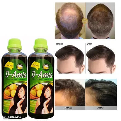 D AMLA Oil for Hair Regrowth Aryuvedic Hair Oil 200ml Hair Oil (200mlx 2)  (400 ml)