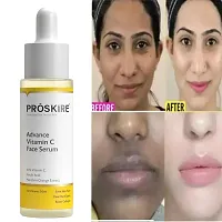 Proskire Advance Vitamin C Face Serum-thumb2