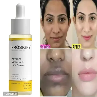 Proskire Advance Vitamin C Face Serum-thumb3