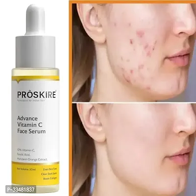 Proskire Advance Vitamin C Face Serum-thumb2