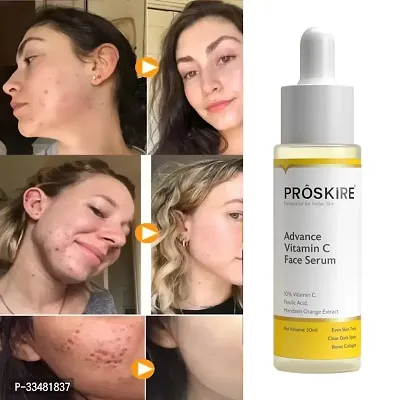 Proskire Advance Vitamin C Face Serum-thumb4